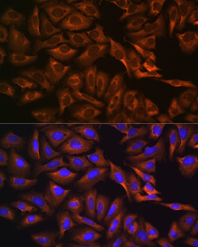 100UL GPIP137 ANTIBODY 100 ul