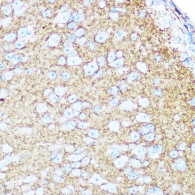 100UL CD56 ANTIBODY 100 ul