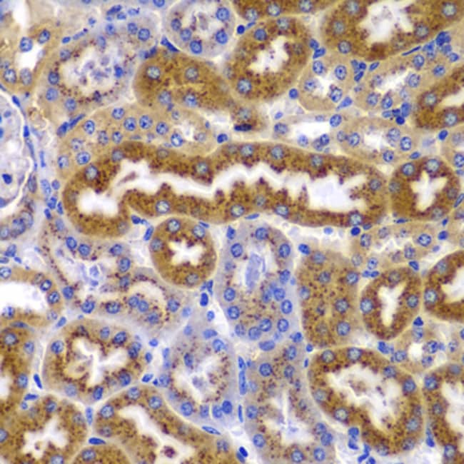 100UL AMPK BETA-1 ANTIBODY 100 ul