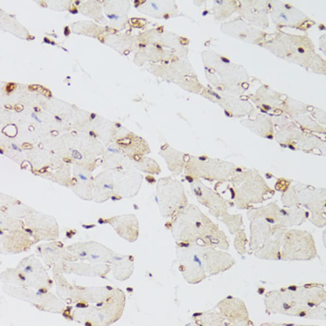 100UL JMJD2A ANTIBODY 100 ul
