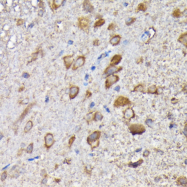 100UL MTHFD1L ANTIBODY 100 ul