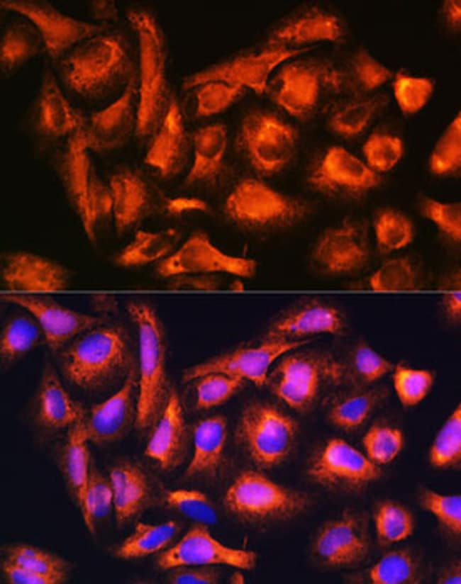 100UL B9D1 ANTIBODY 100 ul