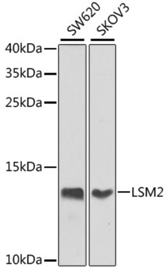 100UL LSM2 ANTIBODY 100 ul