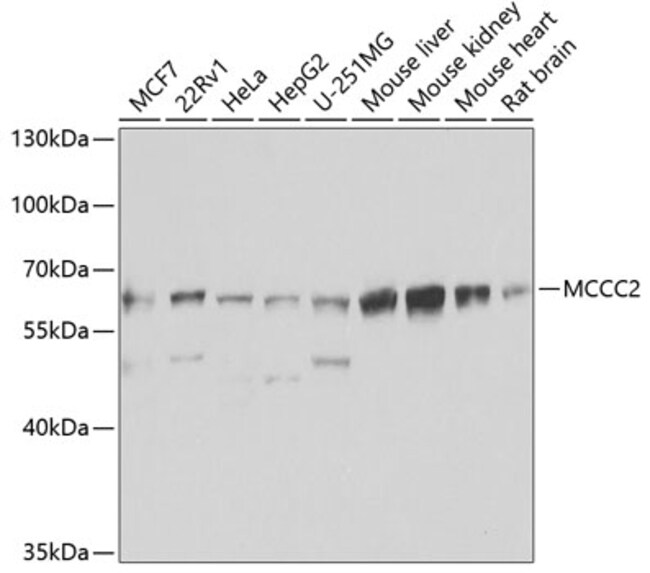 100UL MCCC2 ANTIBODY 100 ul