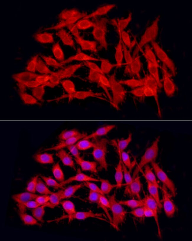 100UL JMJD4 ANTIBODY 100 ul