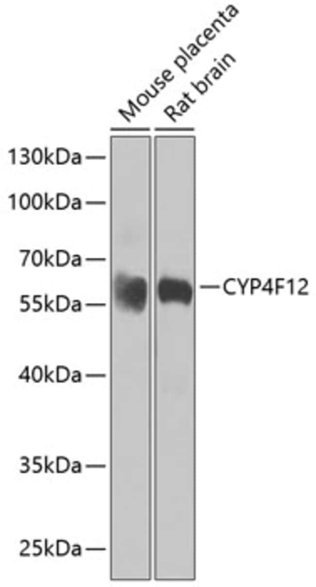 100UL CYP4F12 ANTIBODY 100 ul
