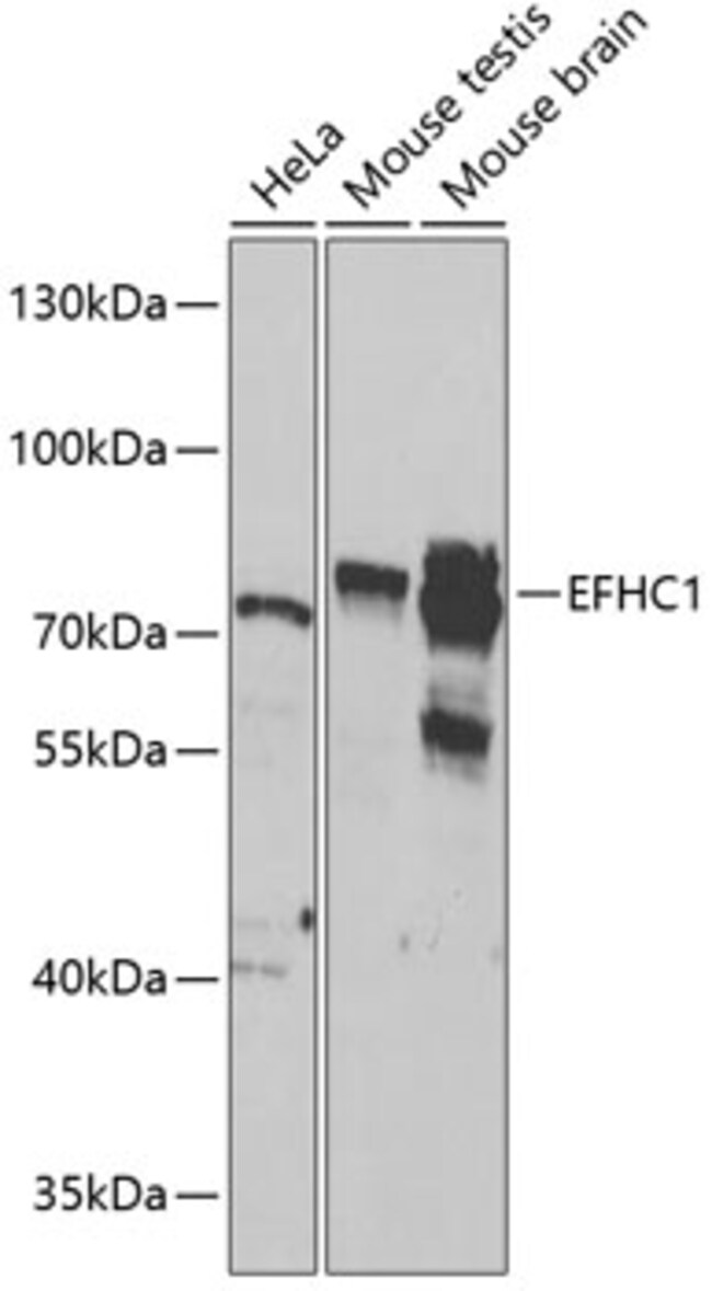 100UL EFHC1 ANTIBODY 100 ul