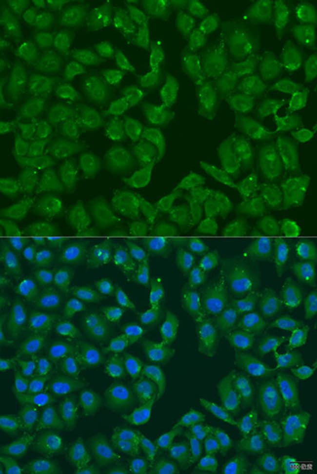100UL MSRB3 ANTIBODY 100 ul