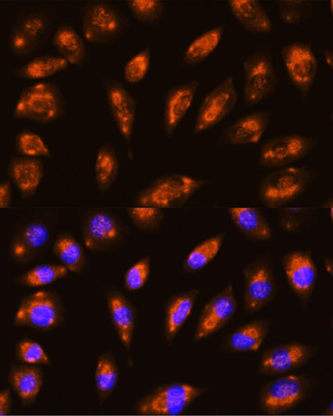 100UL GLUD1 ANTIBODY 100 ul