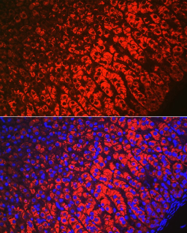 100UL HSD3B1 ANTIBODY 100 ul