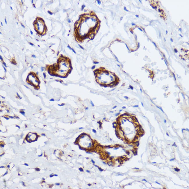 100UL MYLK ANTIBODY 100 ul