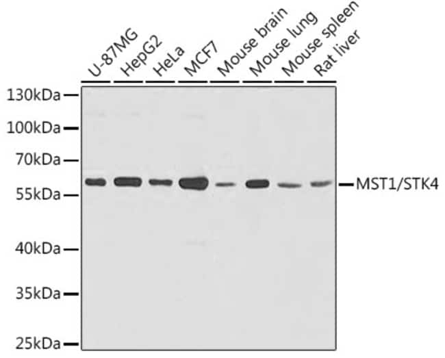 100UL MST1 ANTIBODY 100 ul