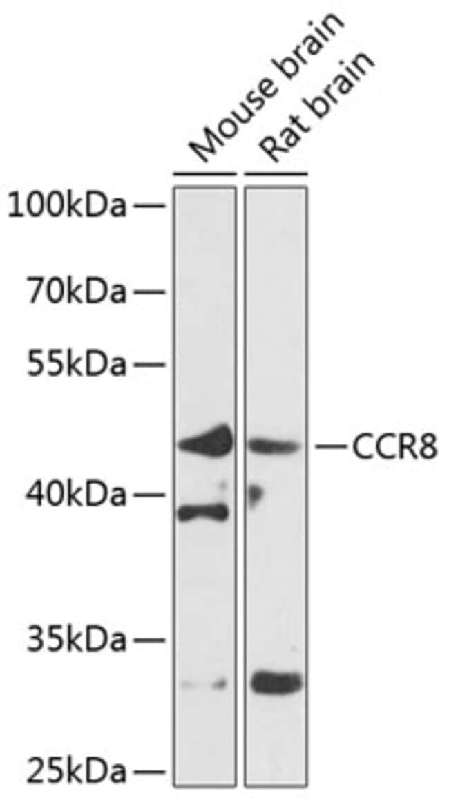 100UL CCR8 ANTIBODY 100 ul