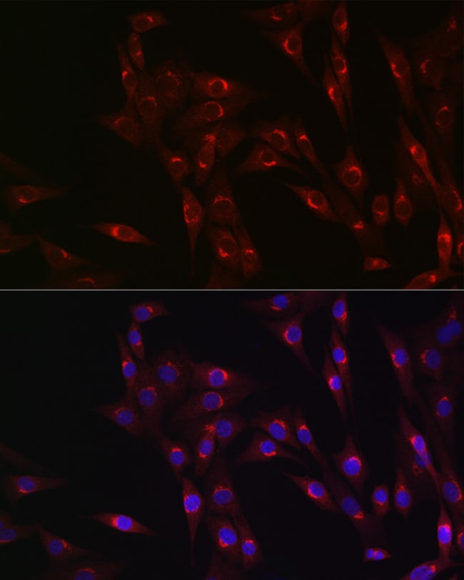 100UL MR1 ANTIBODY 100 ul