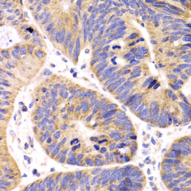 100UL HMGCL ANTIBODY 100 ul