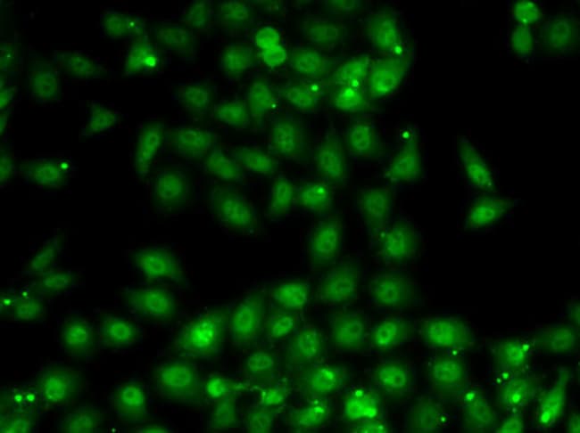 100UL MBNL1 ANTIBODY 100 ul