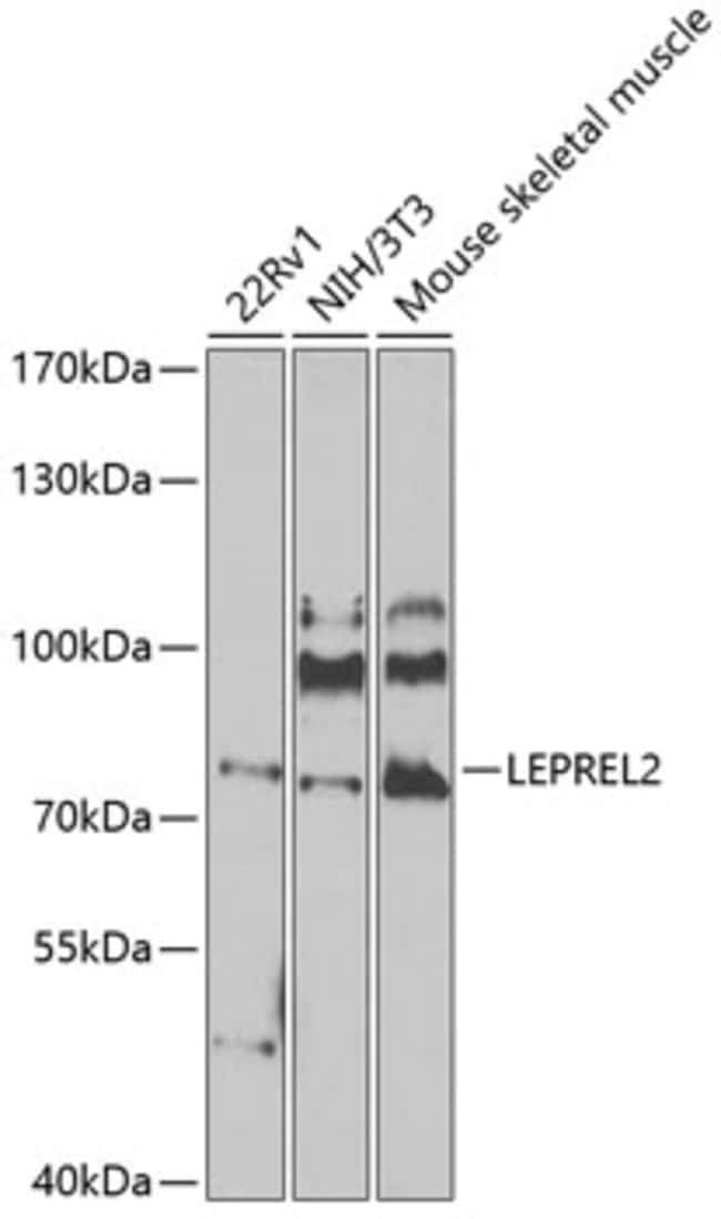 100UL LEPREL2 ANTIBODY 100 ul