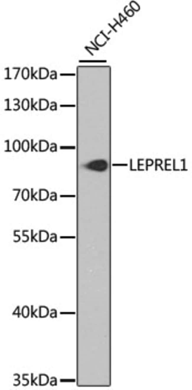100UL LEPREL1 ANTIBODY 100 ul