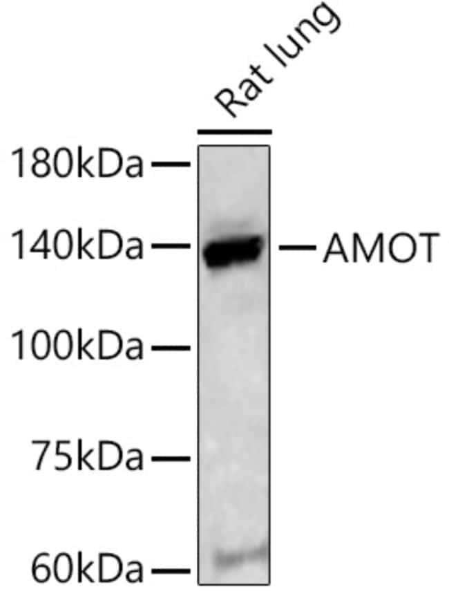 100UL AMOT ANTIBODY 100 ul