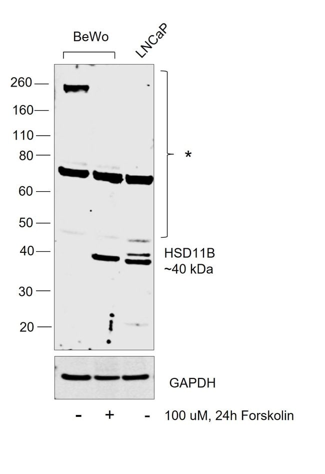 100UL HSD11B2 ANTIBODY 100 ul