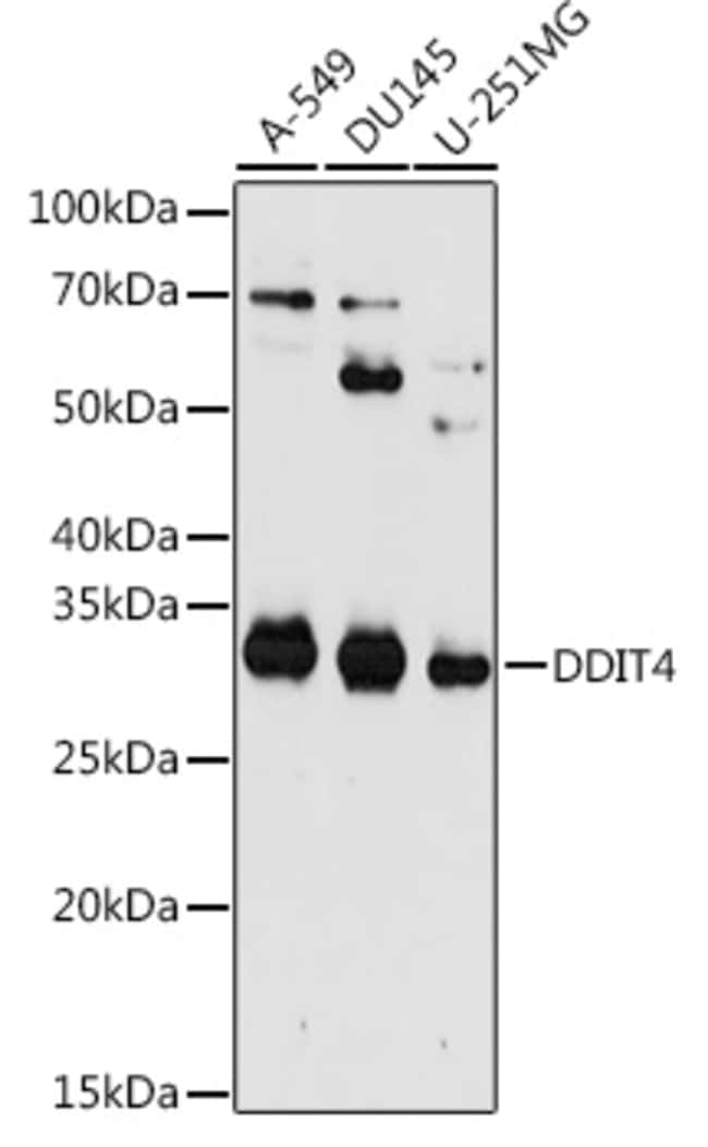 100UL DDIT4 ANTIBODY 100 ul