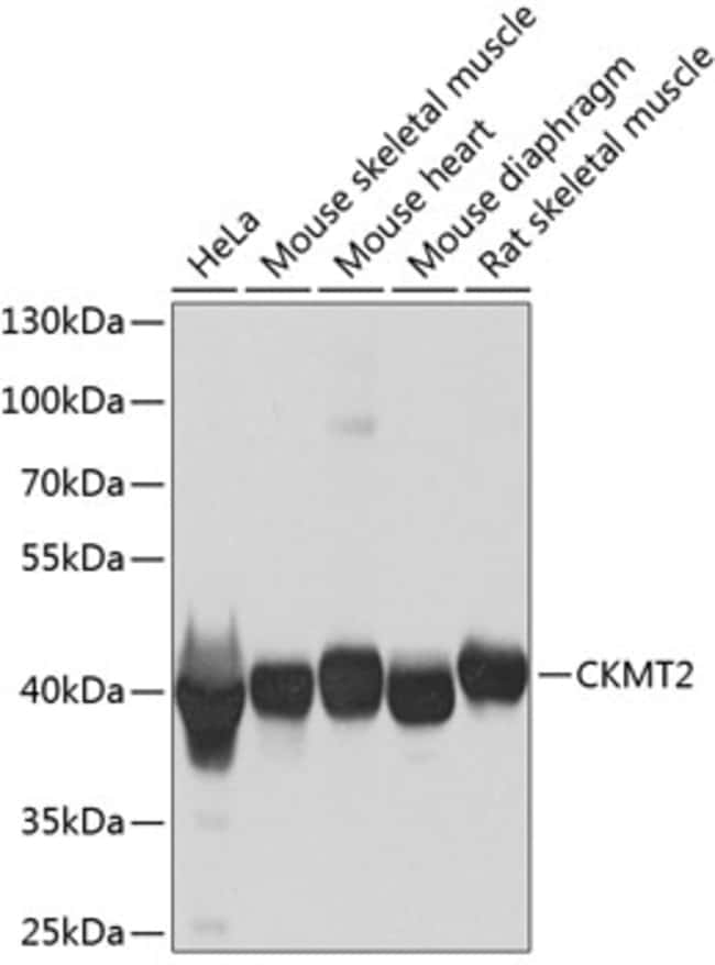 100UL CKMT2 ANTIBODY 100 ul