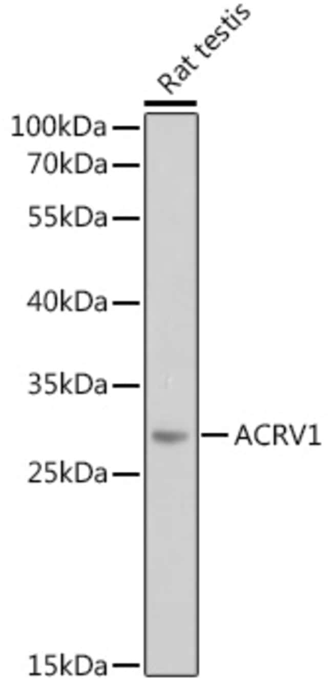 100UL ACROSOMAL VESICLE PROTEIN ANTI 100