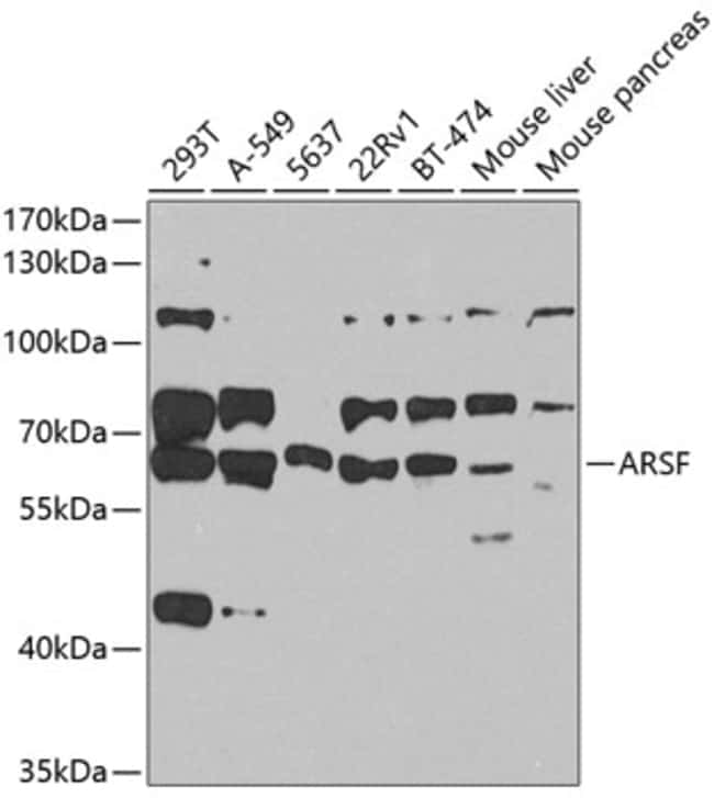 100UL ARYLSULFATASE F ANTIBODY 100 ul