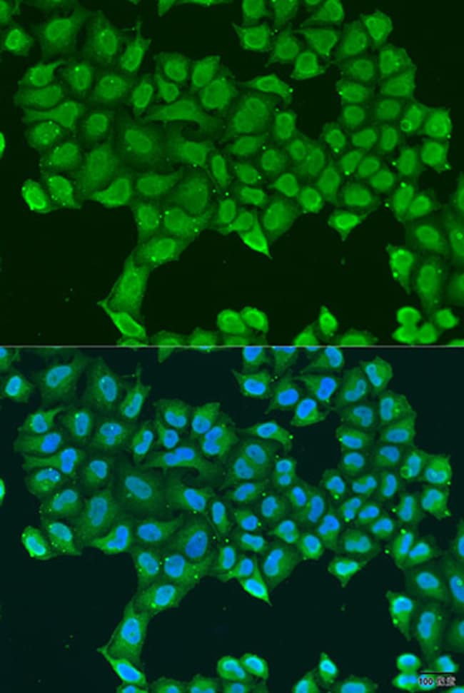 100UL ATP SYNTHASE O ANTIBODY 100 ul