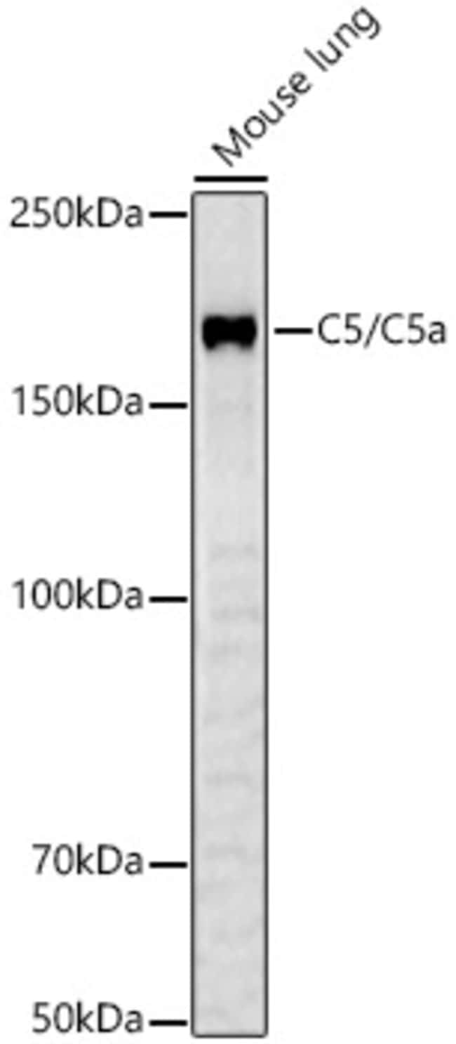 100UL COMPLEMENT C5 ANTIBODY 100 ul