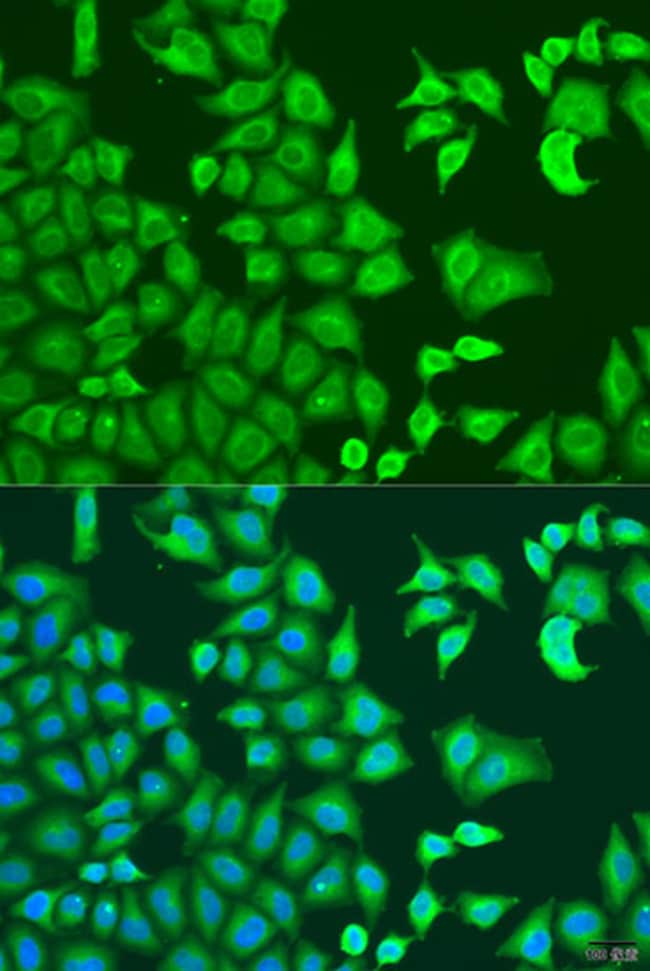 100UL CAPZB ANTIBODY 100 ul