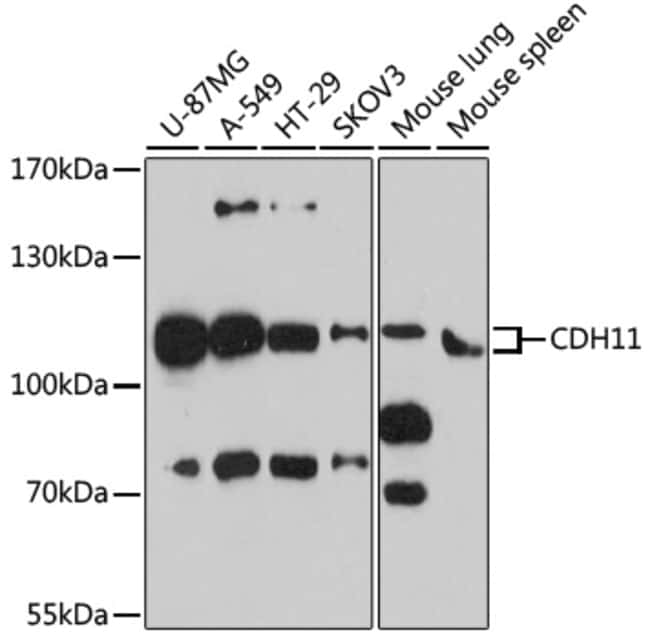 100UL CDH11 ANTIBODY 100 ul