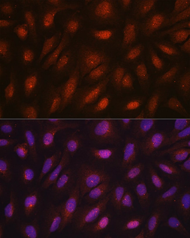 100UL CENTRIN 3 ANTIBODY 100 ul