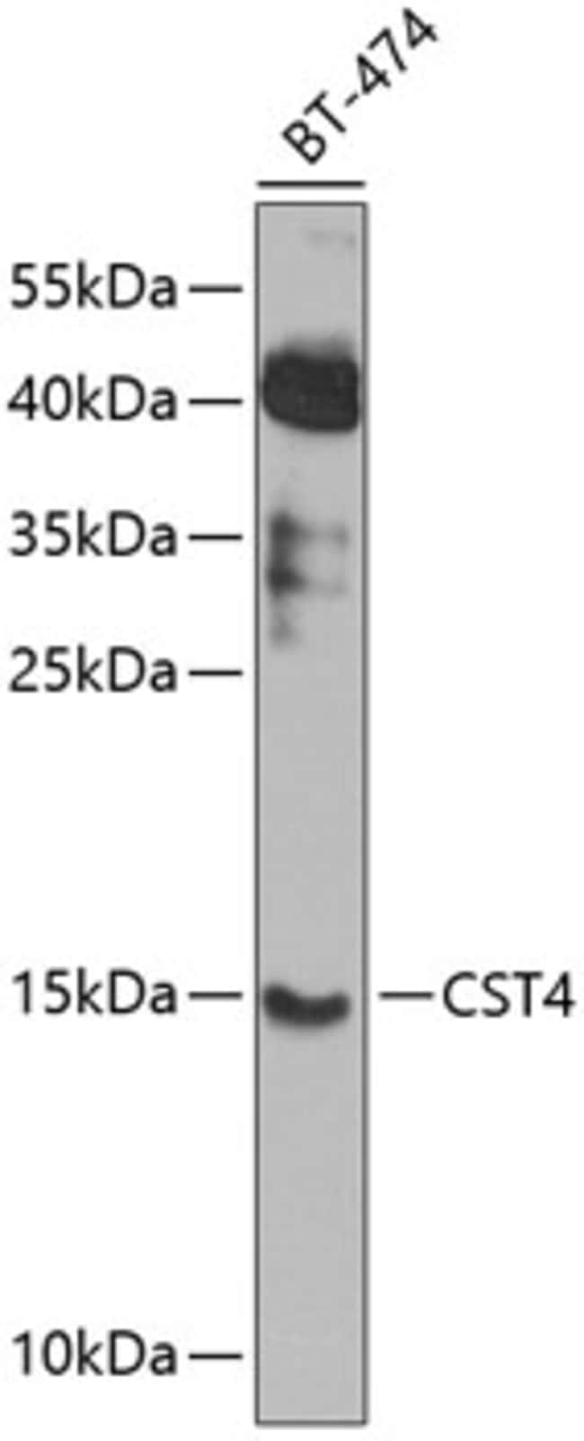 100UL CYSTATIN S ANTIBODY 100 ul