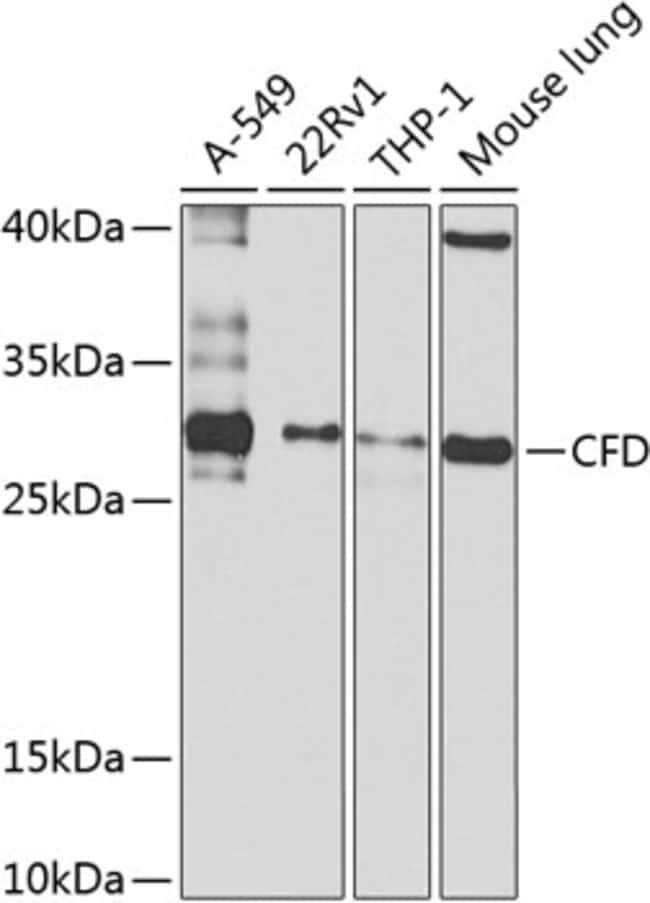 100UL COMPLEMENT FACTOR D ANTIBODY 100 u
