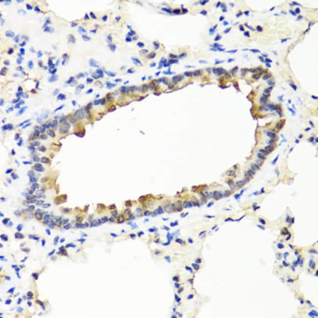 100UL IFN OMEGA ANTIBODY 100 ul