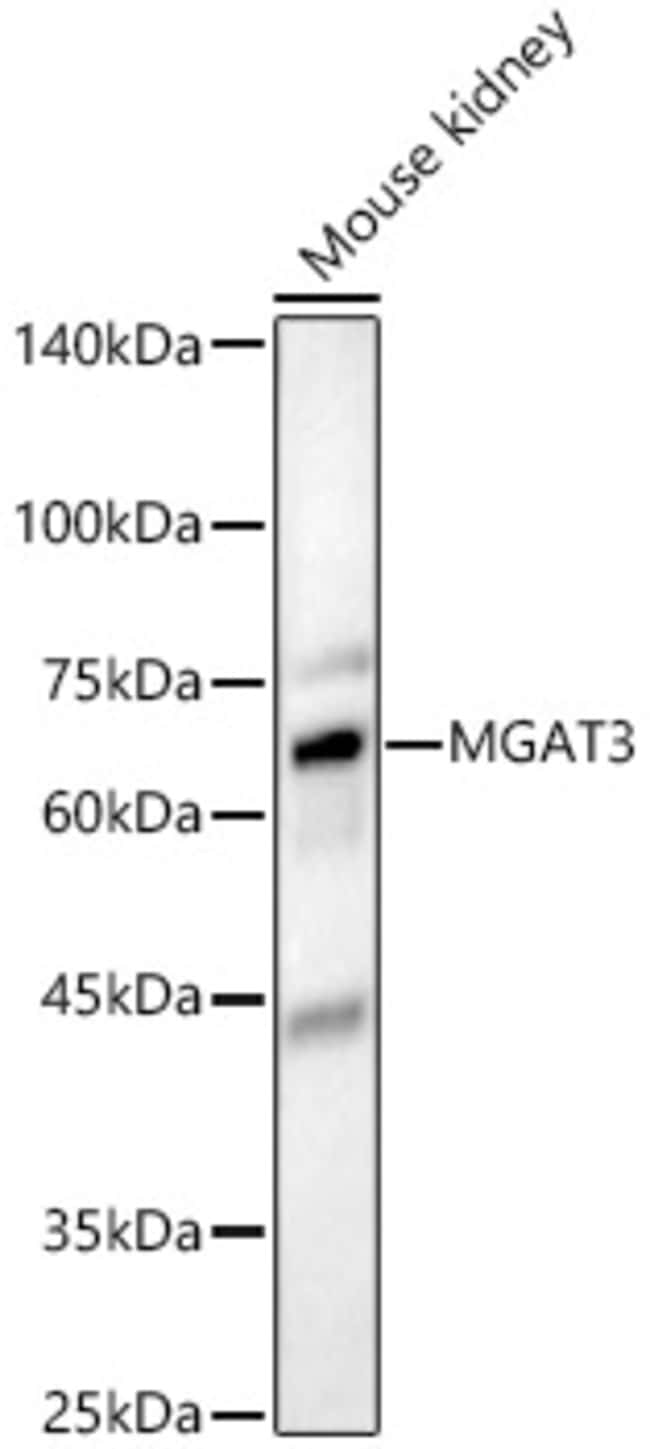100UL MGAT3 ANTIBODY 100 ul