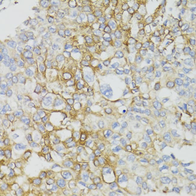 100UL MT-ND5 ANTIBODY 100 ul