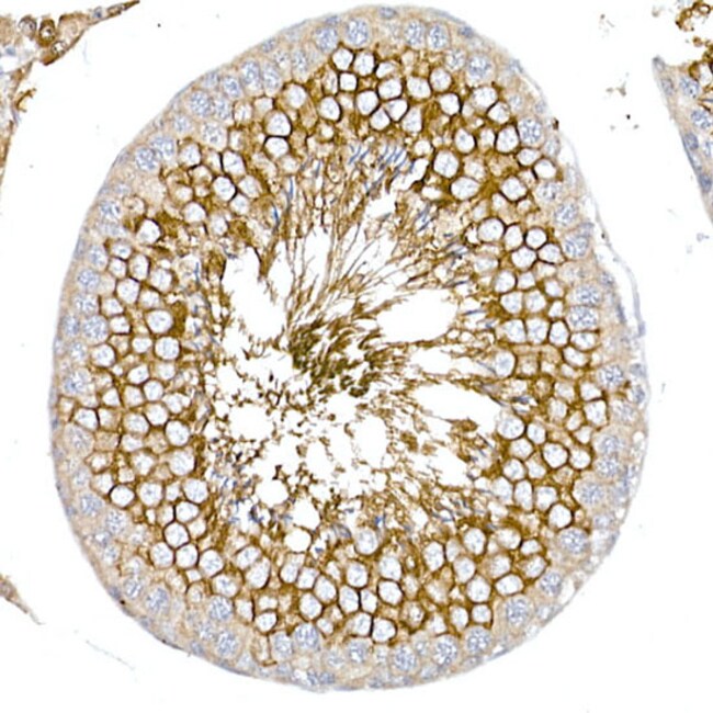 100UL GLUT3 ANTIBODY 100 ul