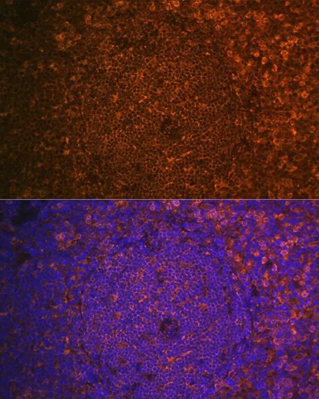 100UL CYSTATIN F ANTIBODY 100 ul
