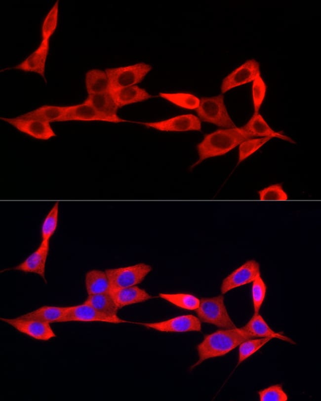 100UL IFI44 ANTIBODY 100 ul
