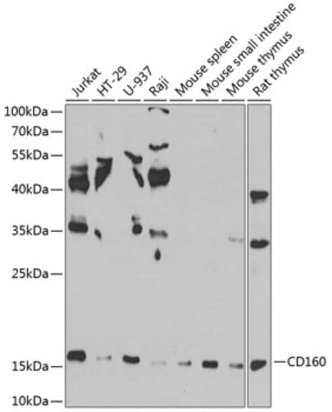 100UL CD160 ANTIBODY 100 ul