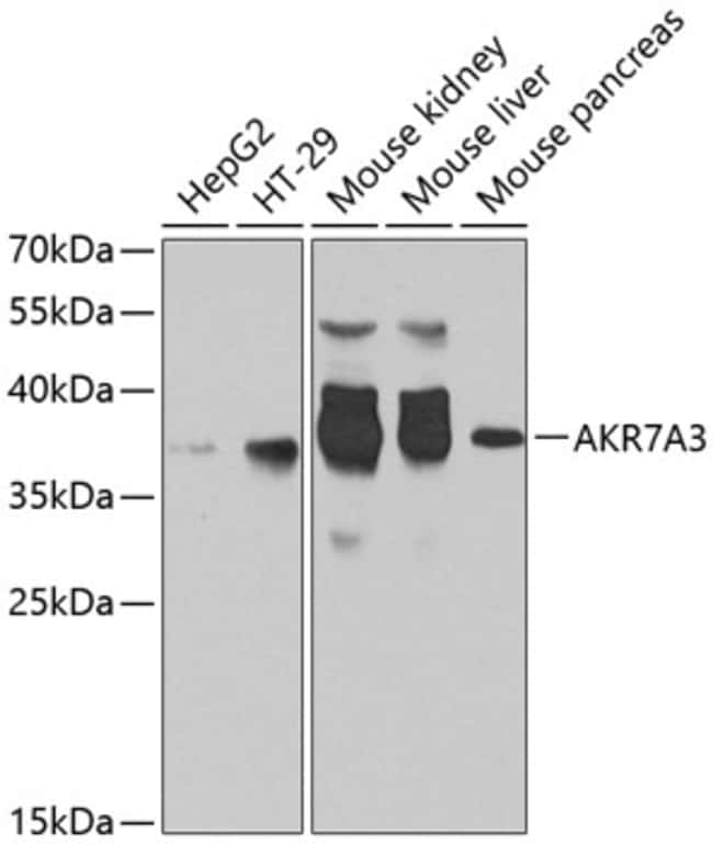 100UL AKR7A3 ANTIBODY 100 ul