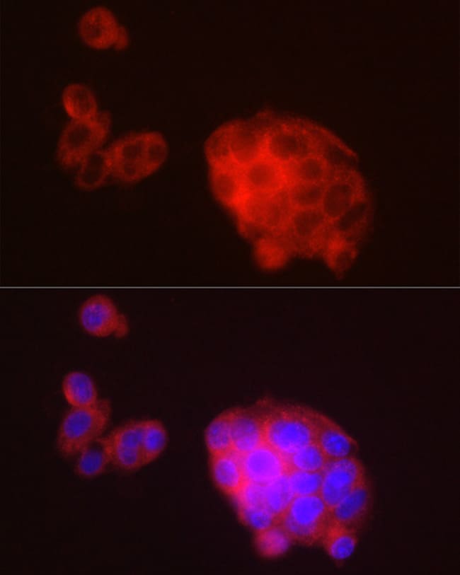 100UL METTL7A ANTIBODY 100 ul