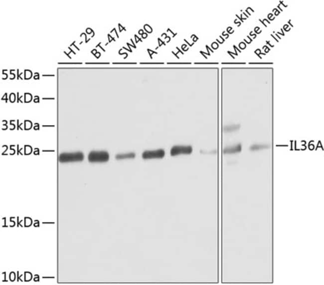 100UL IL1F6 ANTIBODY 100 ul
