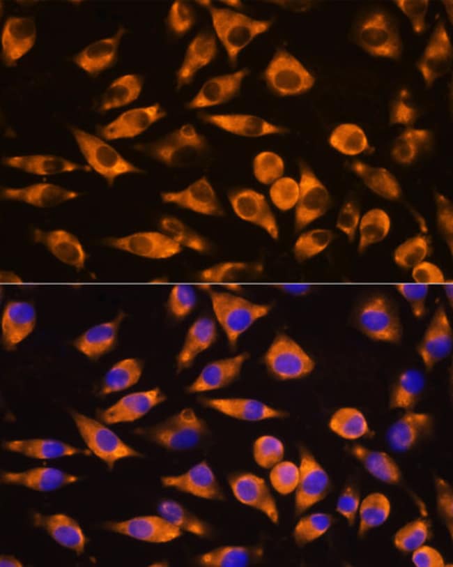 100UL CEP55 ANTIBODY 100 ul
