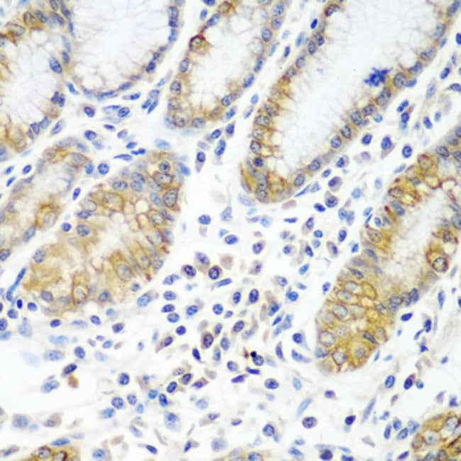 100UL ATAD3A ANTIBODY 100 ul