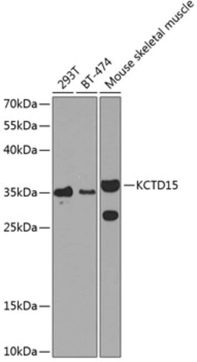 100UL KCTD15 ANTIBODY 100 ul