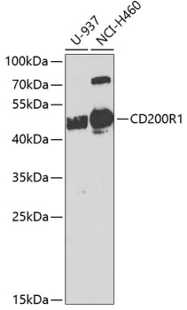 100UL CD200R ANTIBODY 100 ul