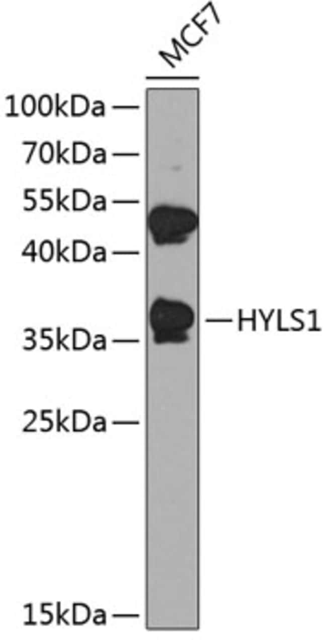 100UL HYLS1 ANTIBODY 100 ul